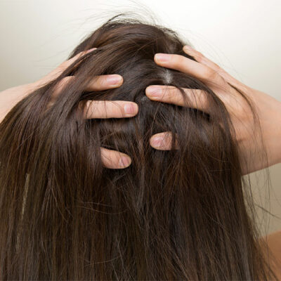 Top 5 Products to Combat Hair Loss