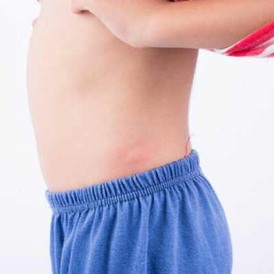 10 common types of skin rashes you should be aware of 