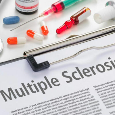 An overview of multiple sclerosis