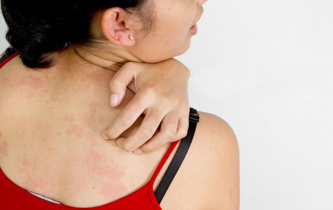 Here are a few common causes of itchy skin