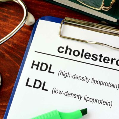 Tips to Lower Cholesterol Levels Naturally