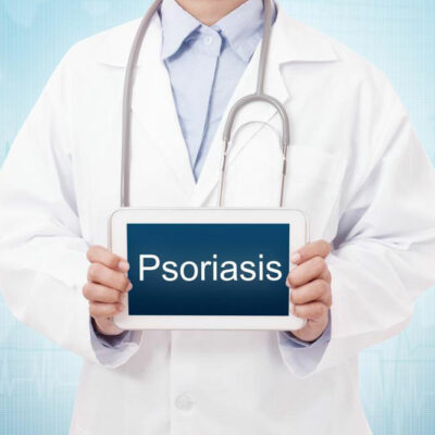 What are the possible plaque psoriasis treatments?