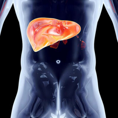 What does stage 4 Hepatitis C mean for your liver