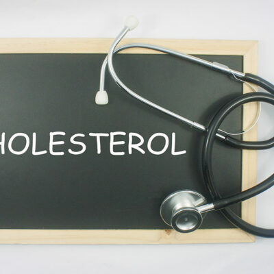 What is cholesterol