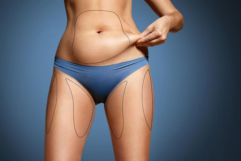 What is coolsculpting fat freezing?