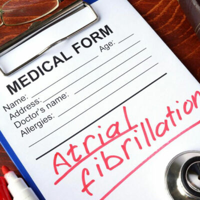 What you should do for AFib treatment