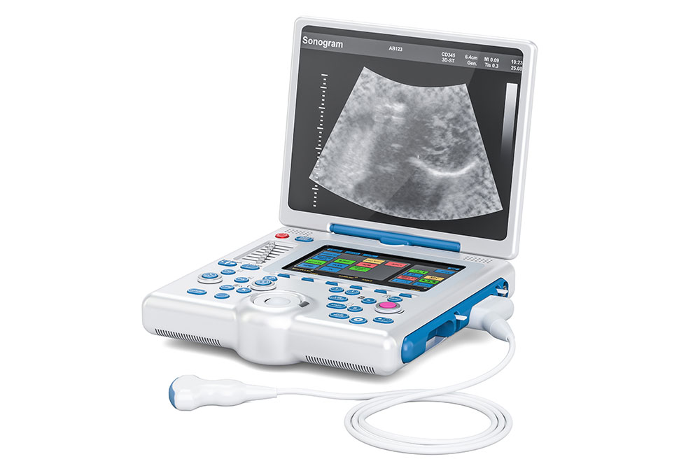 5 best portable ultrasound machines