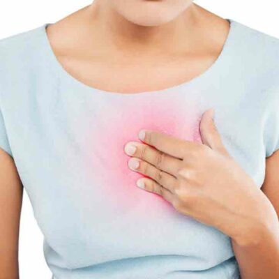 8 Effective Home Remedies for Heartburn