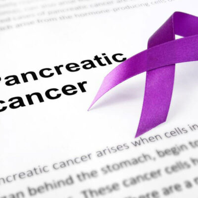 9 Pancreatic Cancer Symptoms You Wouldn’t Believe Exist