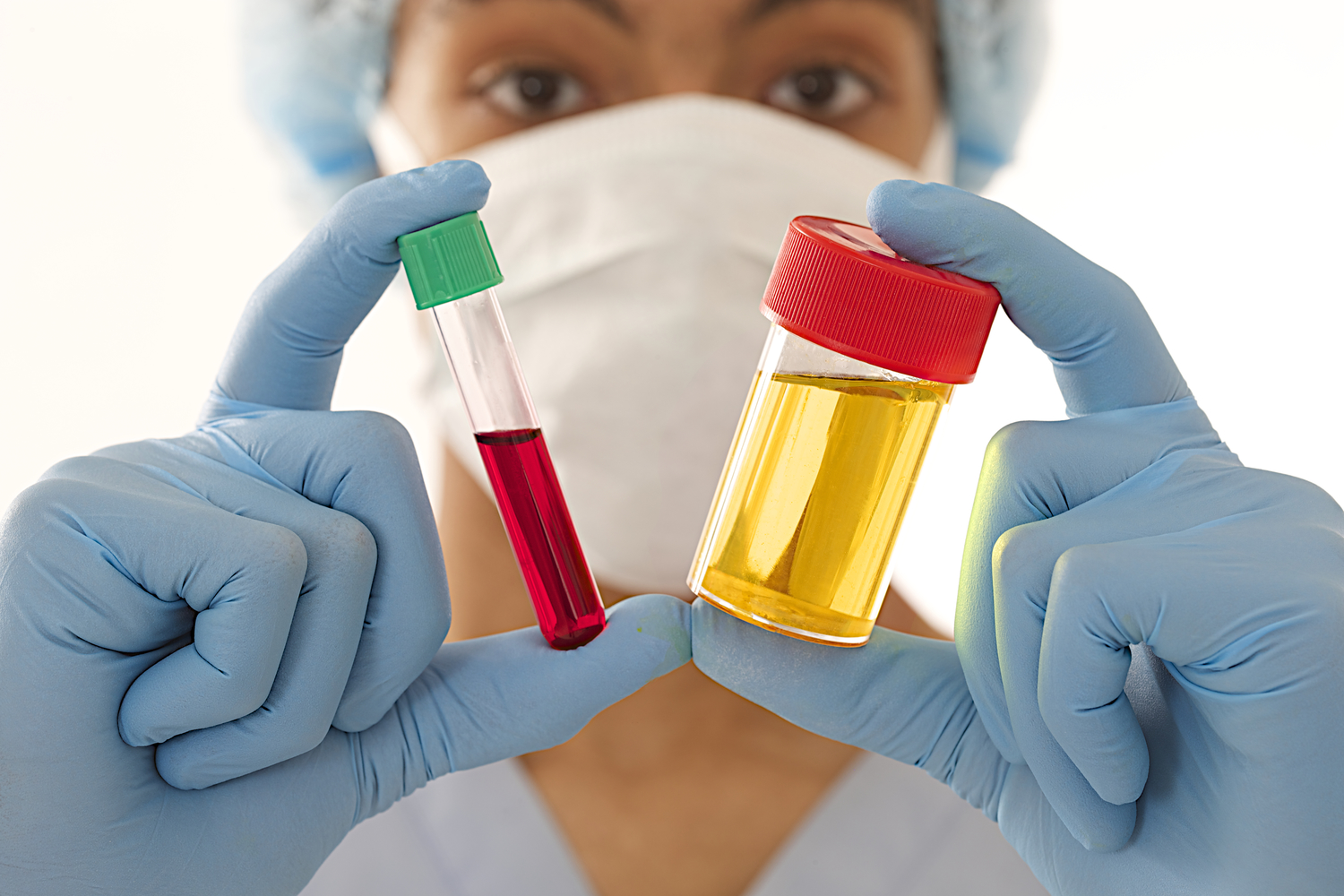 All You Need To Know About Blood In Urine