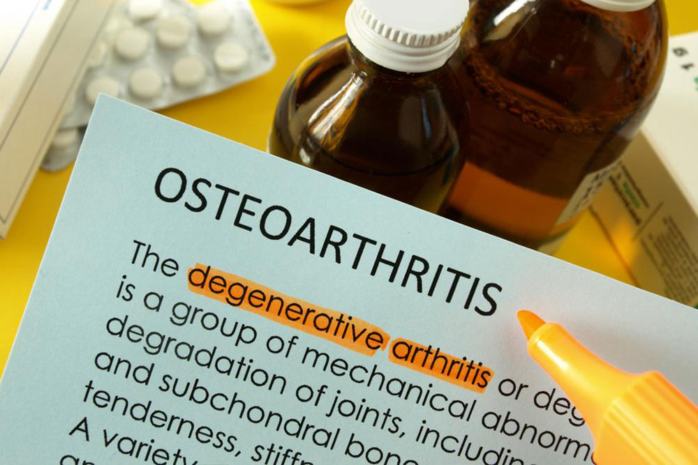 Best Treatment Options for Osteoarthritis of the Knee