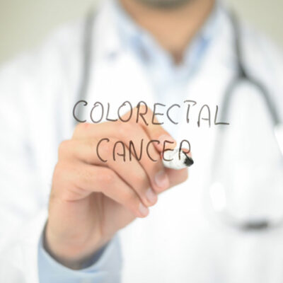 Causes and Diagnosis of Colorectal Cancer