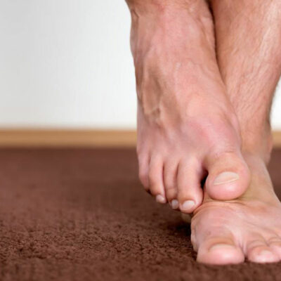 How Diabetes Causes Foot Problems