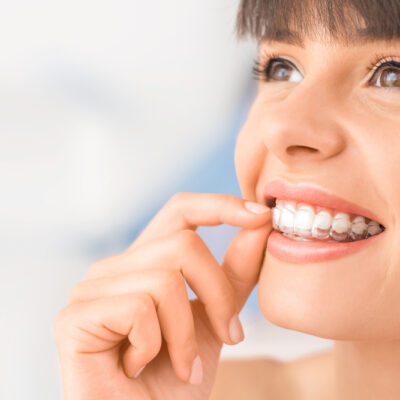 How and why are crowded teeth fixed