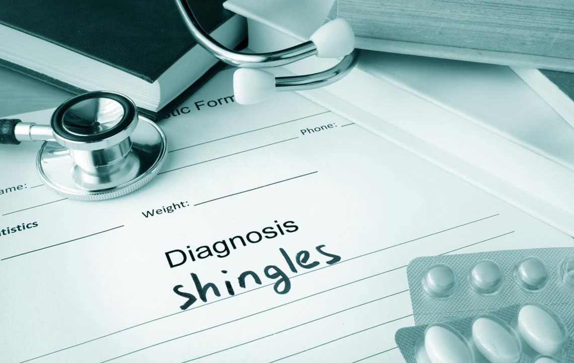 Natural Remedies for Shingles