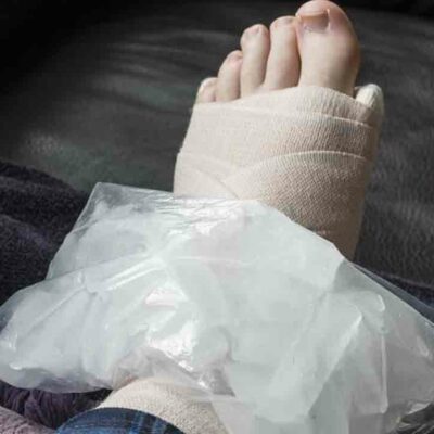 Swollen Ankles Treatment- Basic Yet Effective Ways to Get Rid of Swollen Ankles