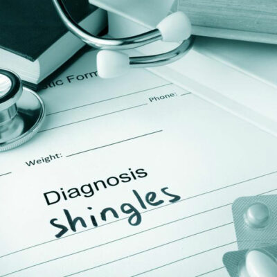 The Best Medication and Natural Treatments for Shingles