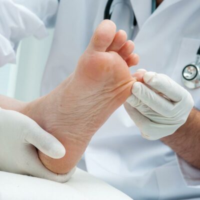 The Best Toenail Fungus Treatment Options For Quick Relief