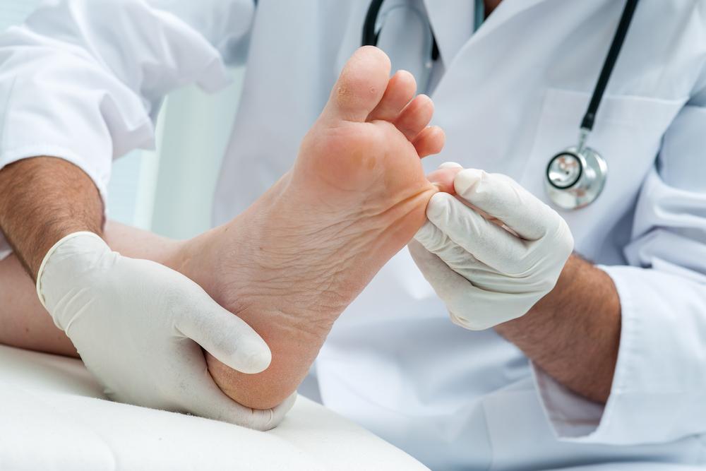 The Best Toenail Fungus Treatment Options For Quick Relief