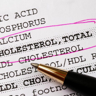 Things You Need To Know About Cholesterol