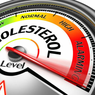 Tips to Manage Your Cholesterol Levels