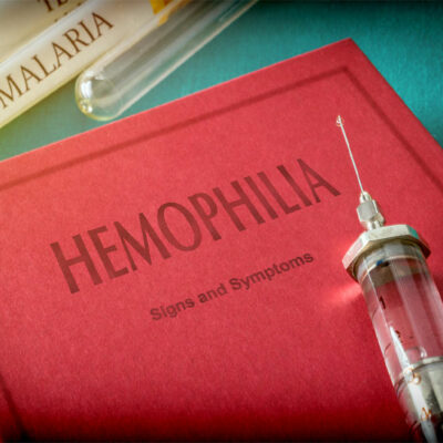 Travel precautions for hemophilia A patients