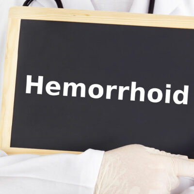 Causes and Treatments of Hemorrhoids