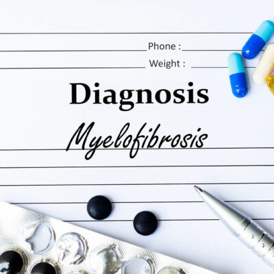 Myelofibrosis &#8211; Symptoms, causes, and management options