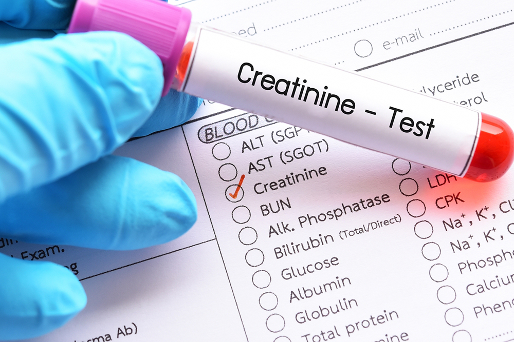 How to Analyze a Creatinine Level Chart